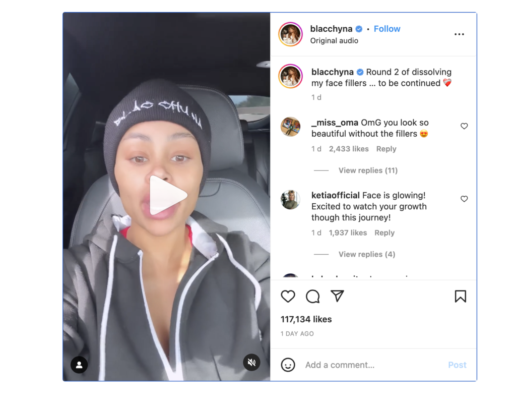 &#8216;Don&#8217;t Even Do It Y&#8217;all, It&#8217;s Not Worth It,&#8217; Blac Chyna warns fans about face fillers as she attempts a second removal, EntertainmentSA News South Africa